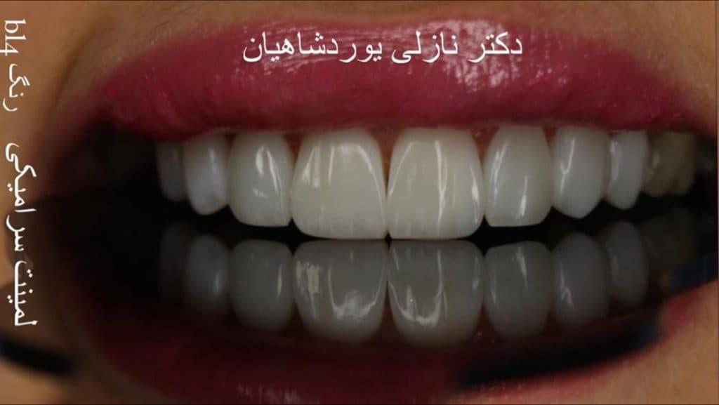 دندانپزشک دکتر نازلی یوردشاهیان در حسنی ارومیه