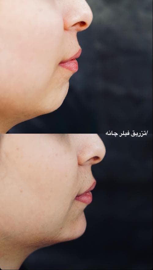 کلینیک زیبایی لیزر لارا در چهارراه عطار شاهین شهر
