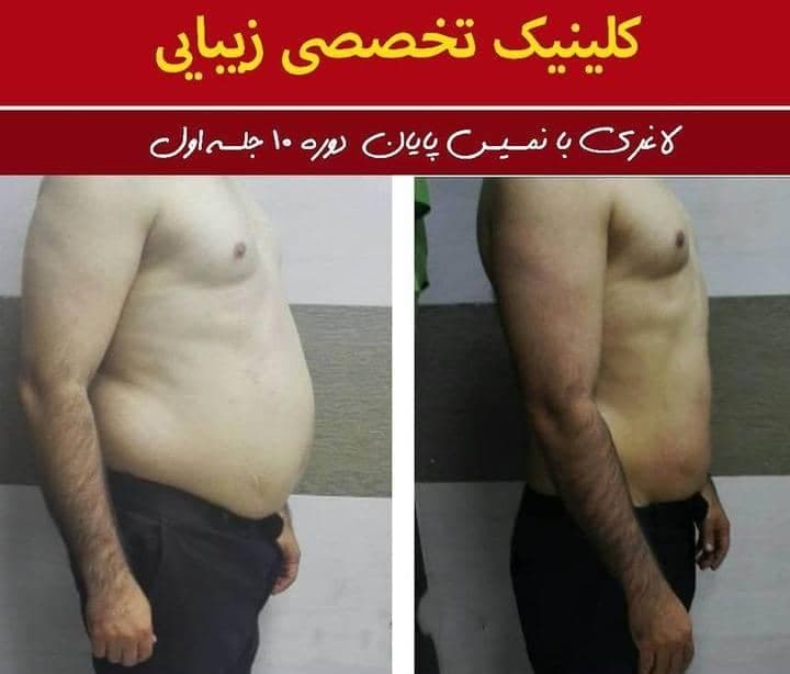 کلینیک لاغری روژینا نادری در اهواز