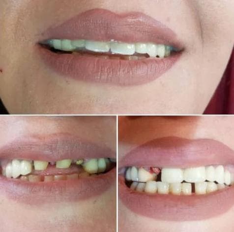 مطب دندانپزشکی دکتر قاسمی در ارومیه