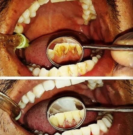 مطب دندانپزشکی دکتر قاسمی در ارومیه