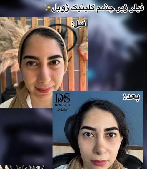 کلینیک زیبایی ژوبل در جردن تهران