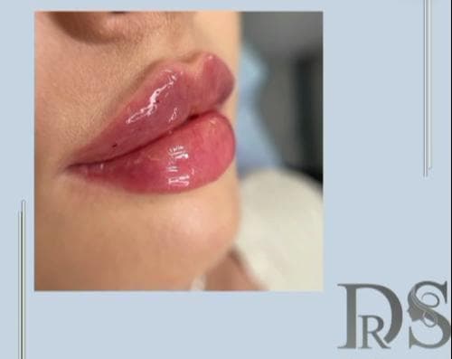 کلینیک زیبایی ژوبل در جردن تهران