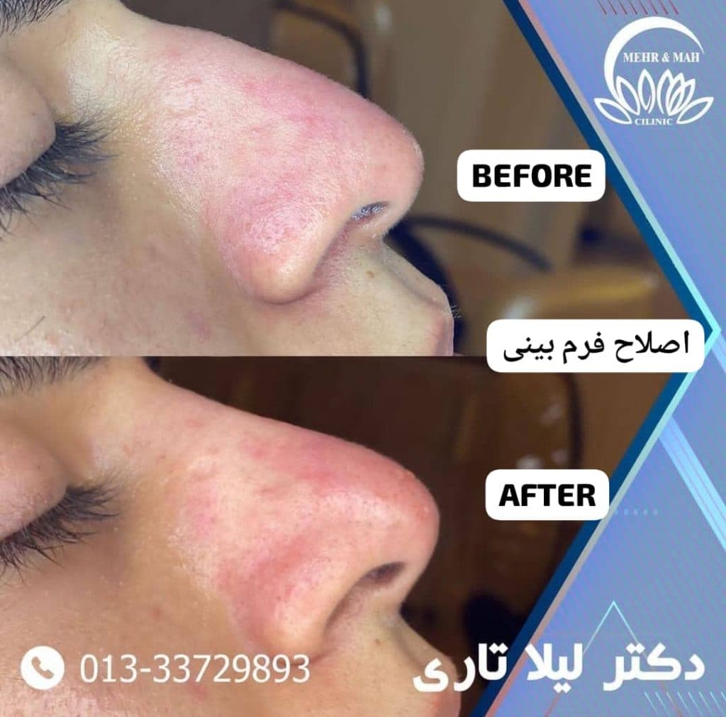 کلینیک زیبایی پوست و مو مهر و ماه در رشت