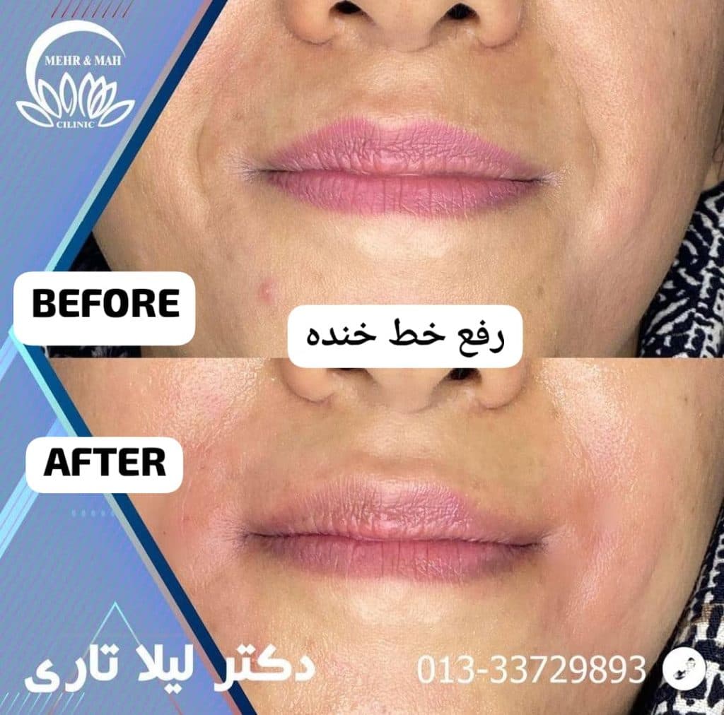 کلینیک زیبایی پوست و مو مهر و ماه در رشت