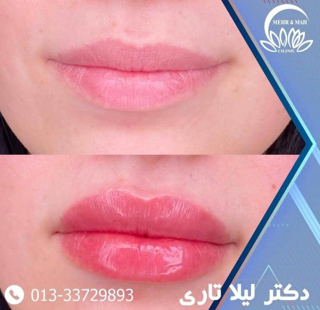 کلینیک زیبایی پوست و مو مهر و ماه در رشت
