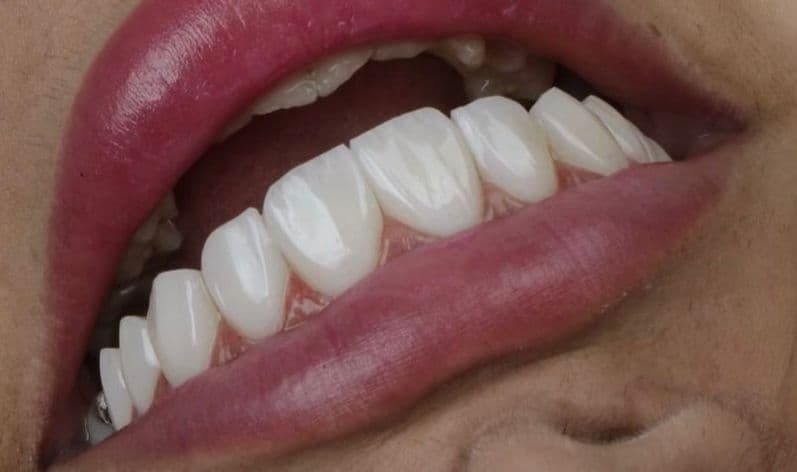 کلینیک دندانپزشکی کاشف در عظیمیه کرج