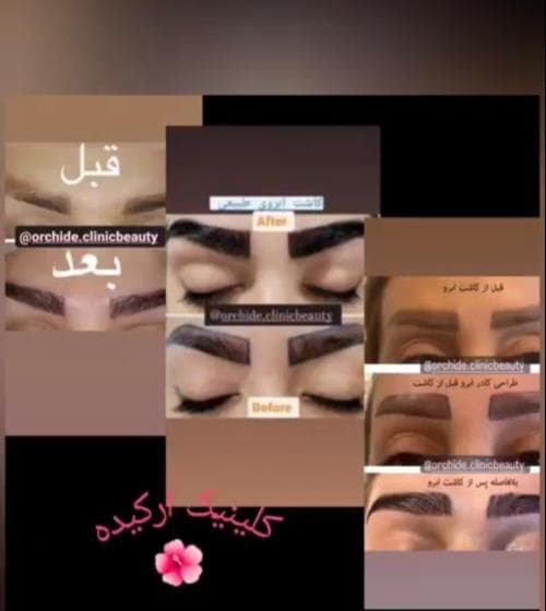 کلینیک زیبایی ارکیده در رودکی تهران
