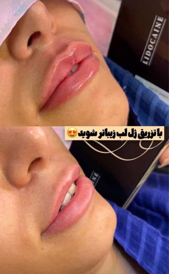 پزشک زیبایی پوست و مو دکتر عاطفه صمیمی در خمینی شهر