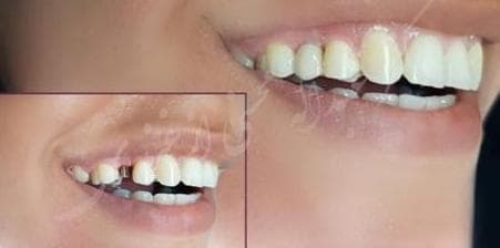 کلینیک دندانپزشکی پارس در مطهری تربت حیدریه