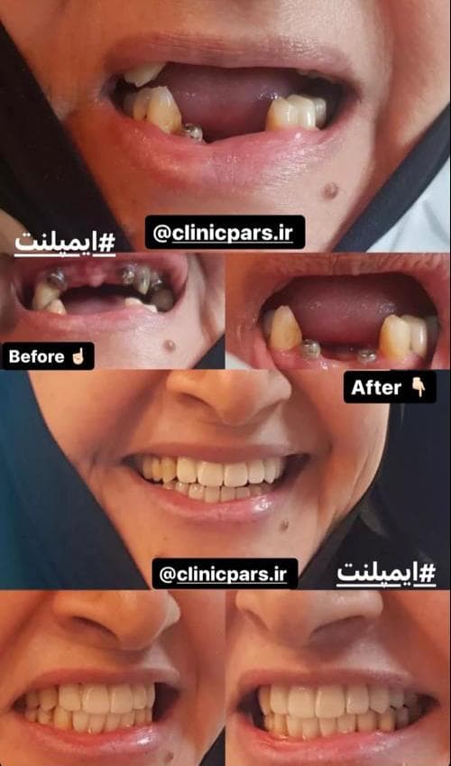 کلینیک دندانپزشکی پارس در مطهری تربت حیدریه
