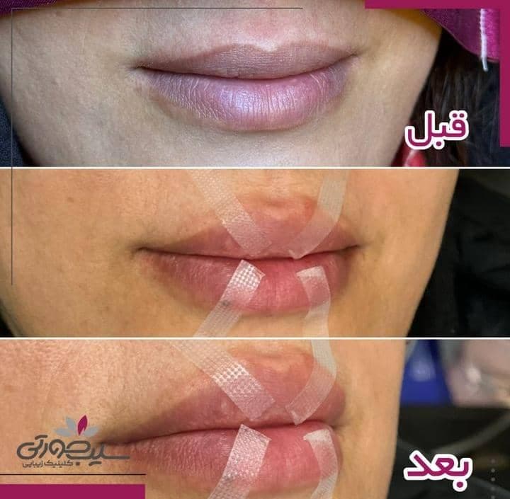 مرکز لیزر زیبایی سیب صورتی در ششم بهمن سنندج