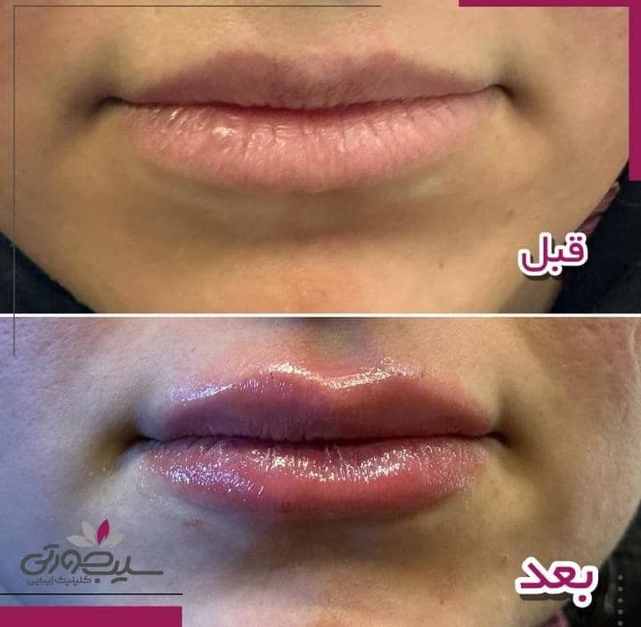 مرکز لیزر زیبایی سیب صورتی در ششم بهمن سنندج