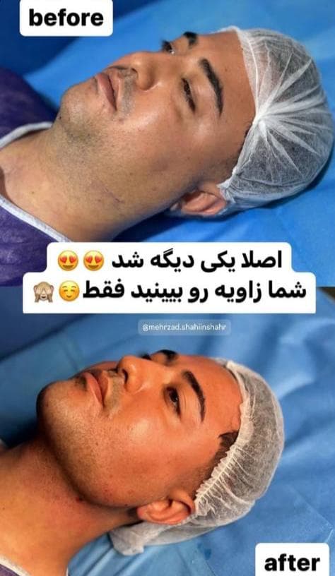 کلینیک زیبایی مهرزاد در رازی شاهین شهر