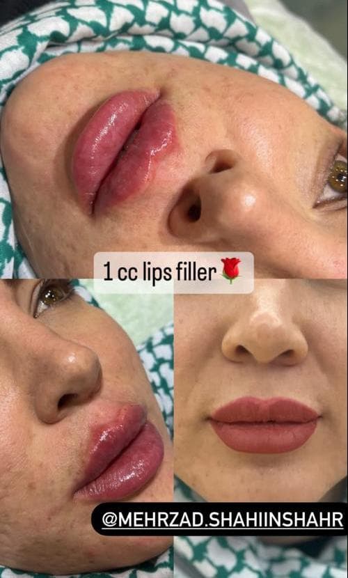 کلینیک زیبایی مهرزاد در رازی شاهین شهر