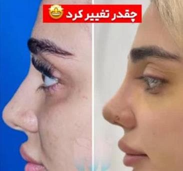 کلینیک زیبایی مهرزاد در رازی شاهین شهر