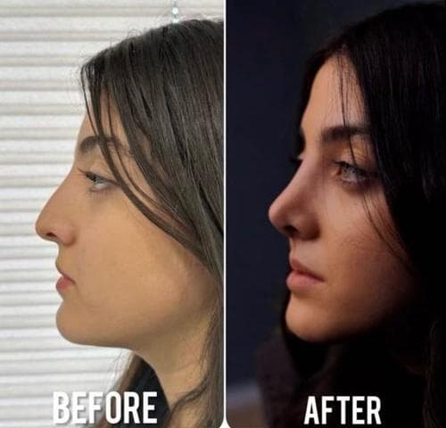 کلینیک زیبایی مهرزاد در رازی شاهین شهر
