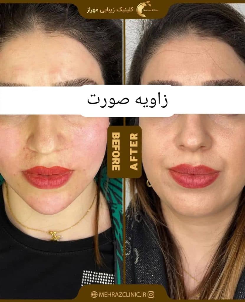 کلینیک زیبایی لیزر مهراز در تهران