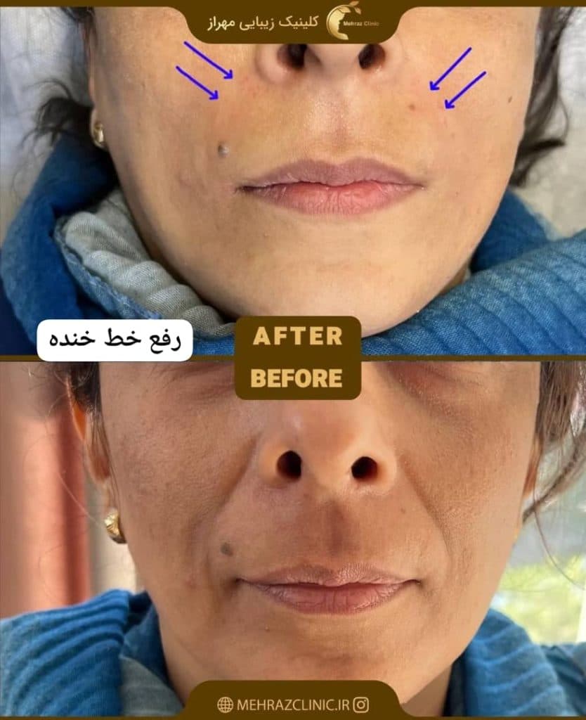 کلینیک زیبایی لیزر مهراز در تهران