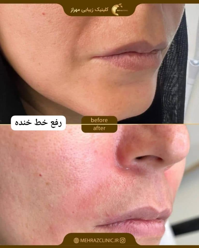 کلینیک زیبایی لیزر مهراز در تهران