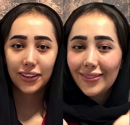 کلینیک زیبایی طلا در عبدل آباد تهران