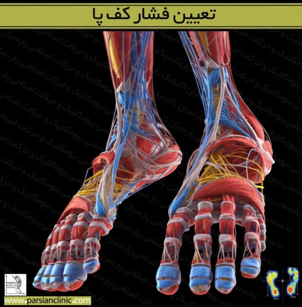 کلینیک بیومکانیک و حرکات اصلاحی پارسیان در مفتح جنوبی تهران