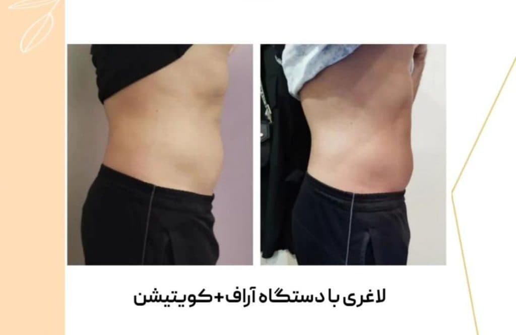 کلینیک تغذیه و رژیم درمانی آناهیتا در قدوسی غربی شیراز