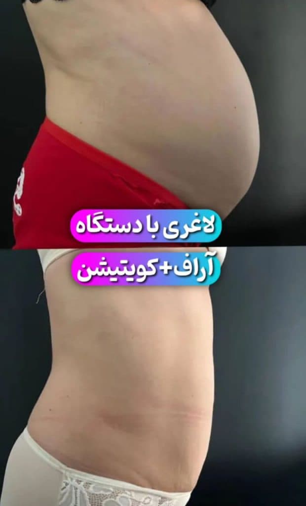 کلینیک تغذیه و رژیم درمانی آناهیتا در قدوسی غربی شیراز