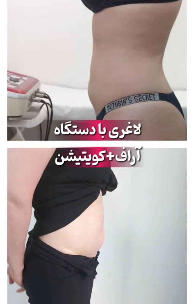 کلینیک تغذیه و رژیم درمانی آناهیتا در قدوسی غربی شیراز