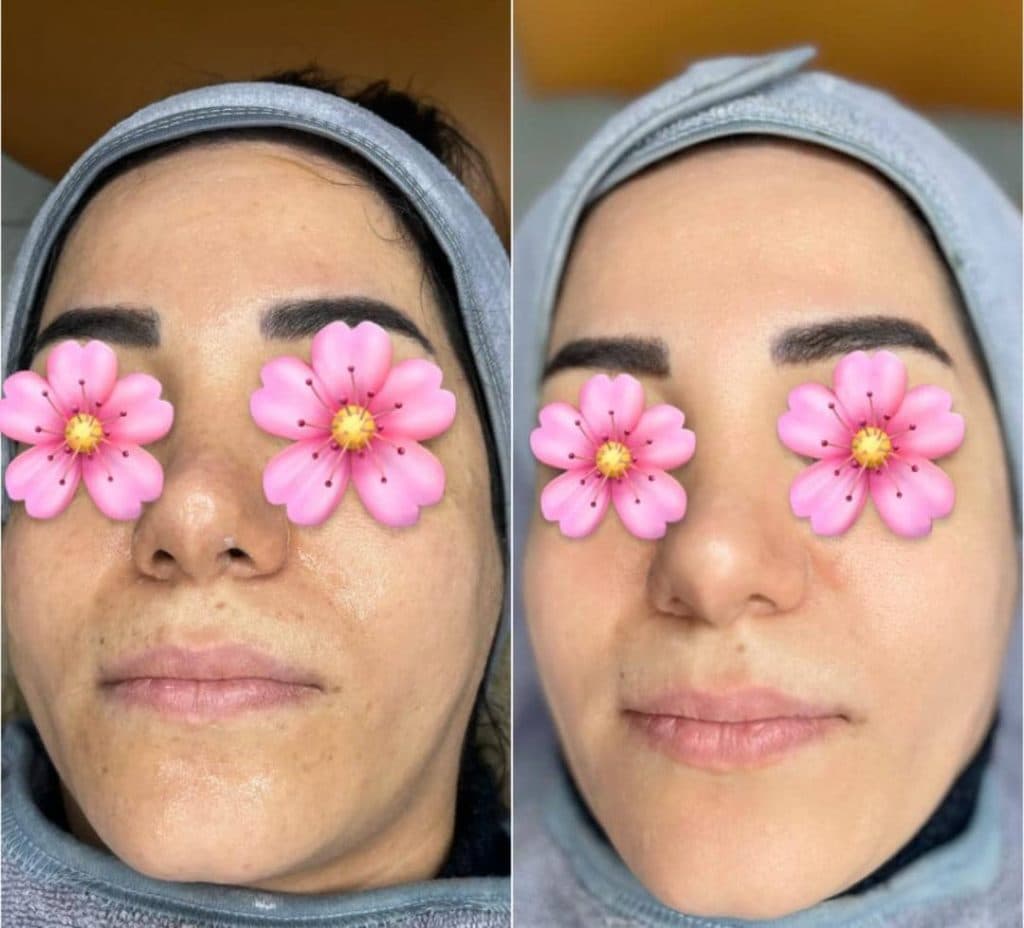 مرکز لیزر شاین در مجیدیه تهران
