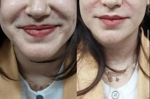 کلینیک زیبایی پوست و مو آرسام در بابلسر