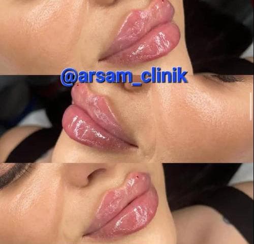 کلینیک زیبایی پوست و مو آرسام در بابلسر