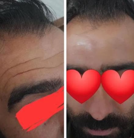کلینیک زیبایی پوست و مو آرسام در بابلسر