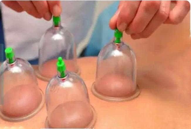 طب سنتی بختیاری در یزد