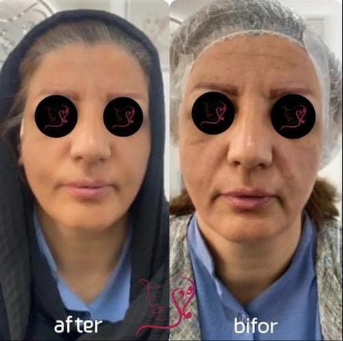 کلینیک زیبایی لیزر ماه دی در فردیس کرج