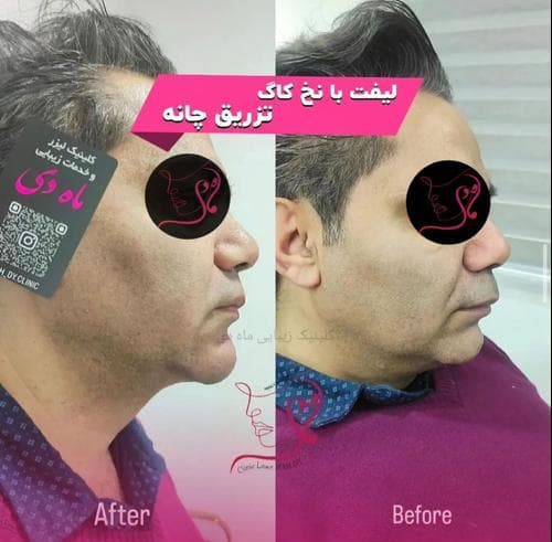 کلینیک زیبایی لیزر ماه دی در فردیس کرج