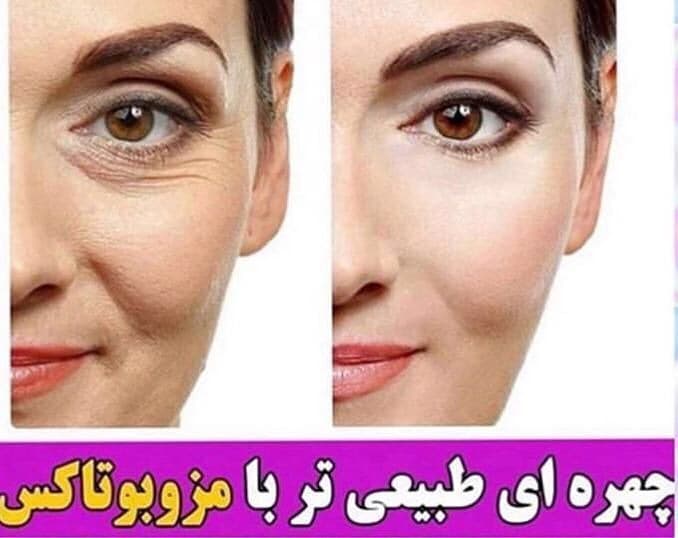 مرکز تخصصی vip لیزر موهای زائد لیلیوم در گوهردشت کرج