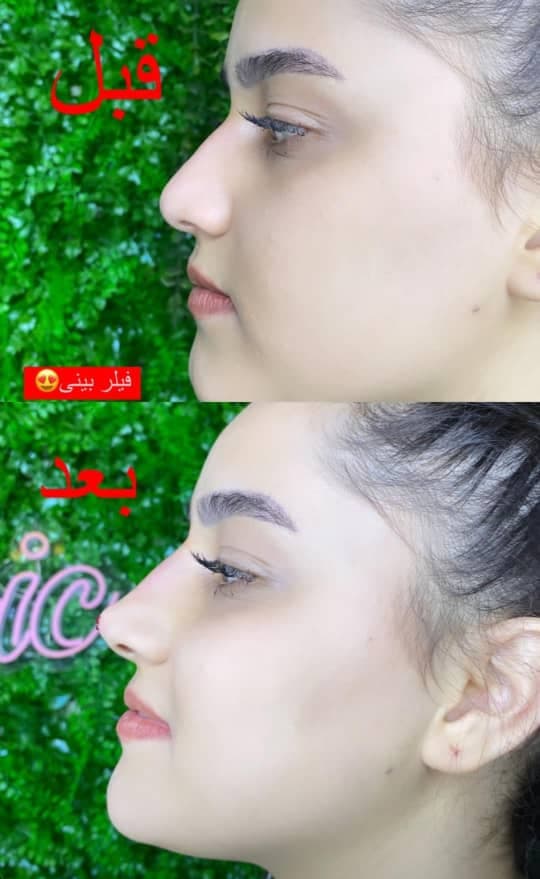 کلینیک زیبایی ایرانیان دکتر مهسا فتحی در ارومیه