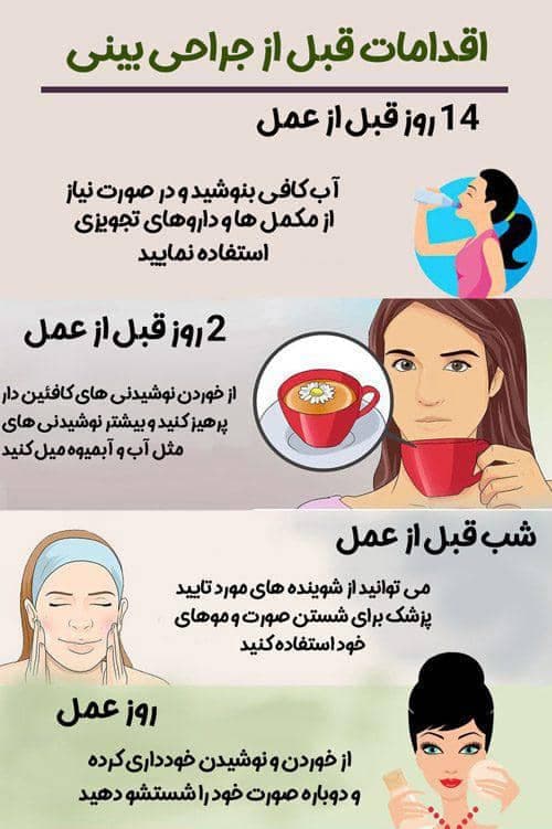 عکاسی جراحی عکاسخانه شهر خالصی زاده در سه راه شحنه یزد