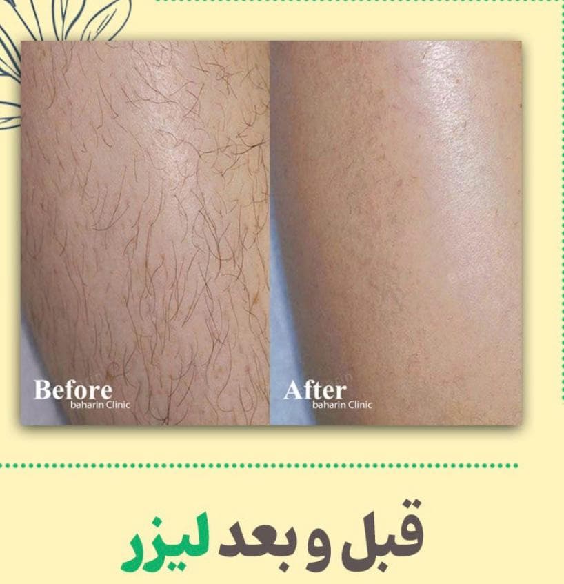 کلینیک پوست مو مانلی در آبادان