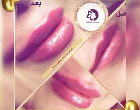 کلینیک پوست و مو نیلوفر در مشهد