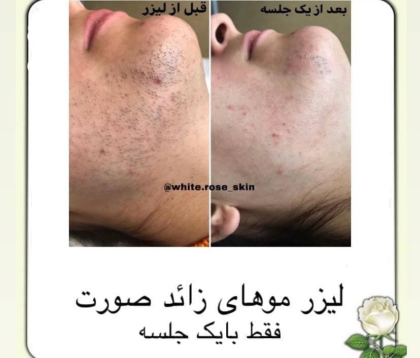 کلینیک زیبایی دلارز در گلشهر کرج