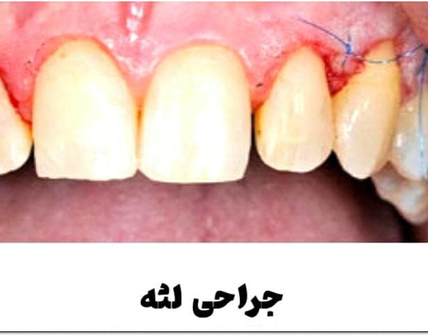 دندانپزشکی دکتر الهام علی قلی زاده در خرمشهر