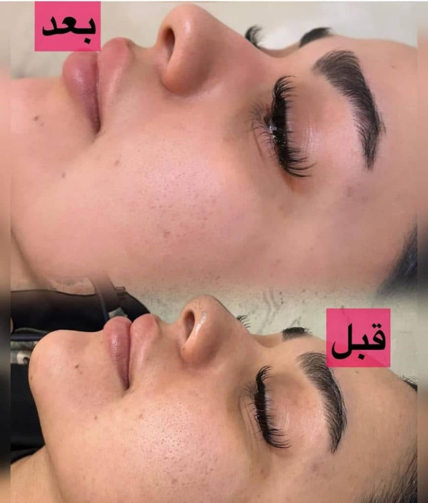 آکادمی پوست و مو راضیه یاری در اصفهان