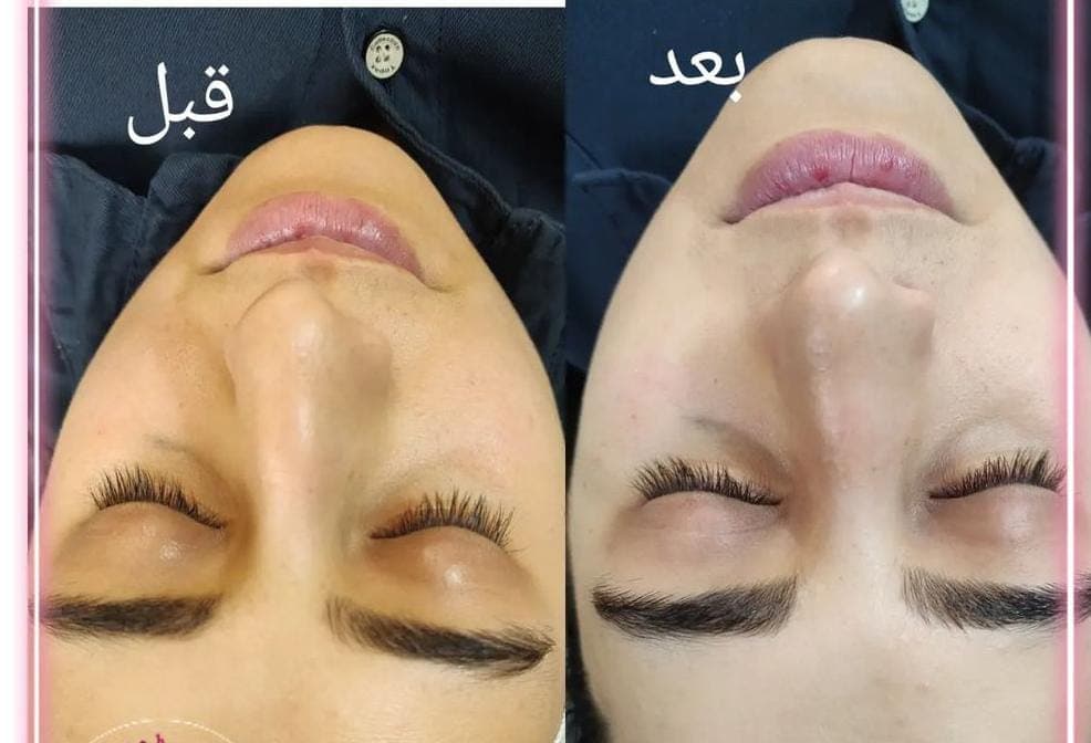 آکادمی پوست و مو راضیه یاری در اصفهان