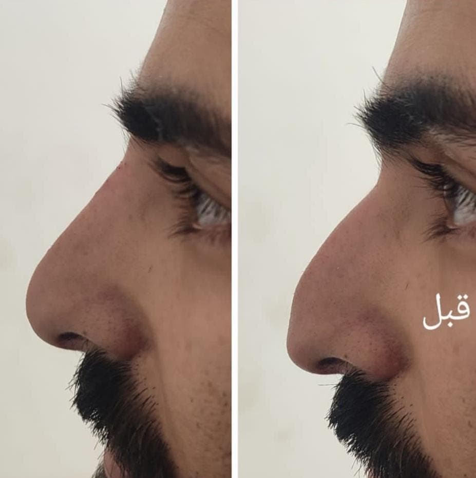 کلینیک تخصصی لاغری و تناسب اندام امولای در بلوار احمدآباد مشهد