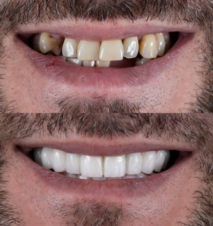 مطب دندانپزشکی و ایمپلنت دکتر رضا شکیبایی در سلسبیل تهران