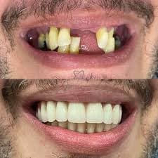 مطب دندانپزشکی و ایمپلنت دکتر رضا شکیبایی در سلسبیل تهران