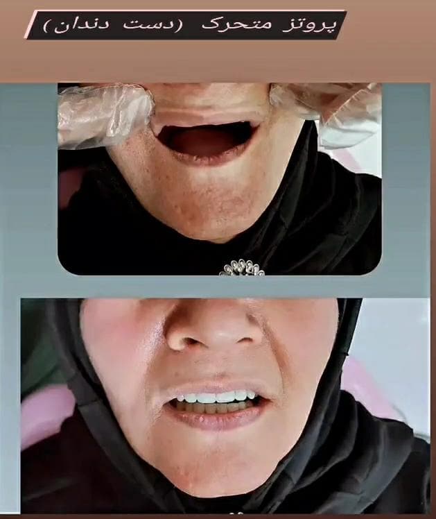 لابراتور دندانسازی اهورا در مشهد