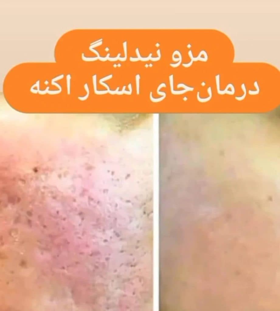 کلینیک تخصصی پوست و مو سوگند شکیبا در قائم شهر